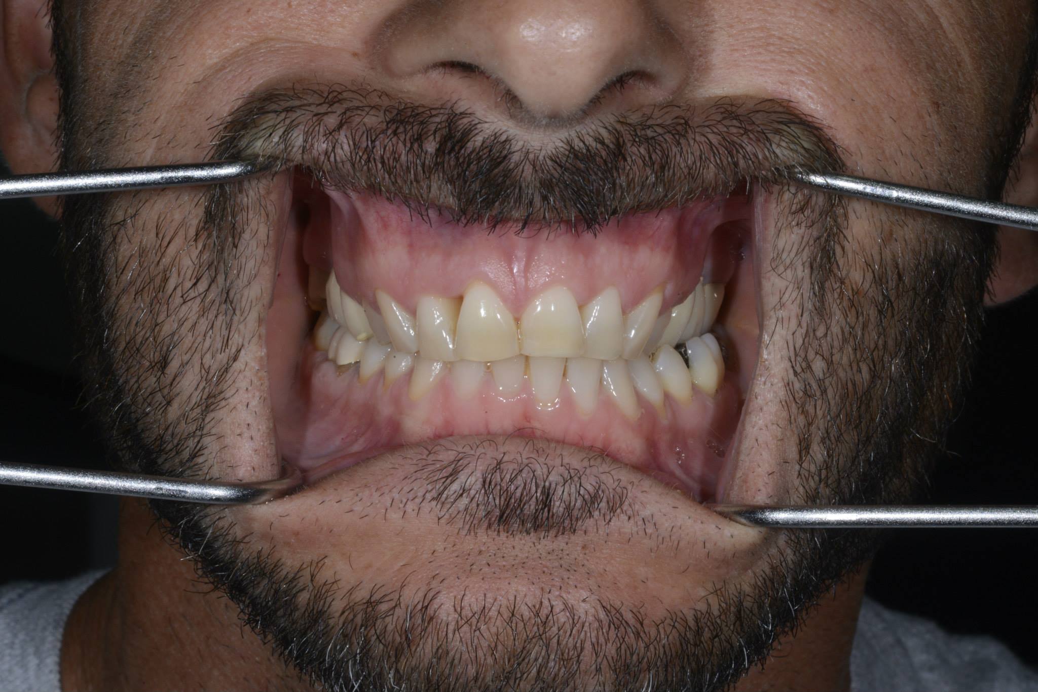 1523649 384526731696560 1335056617781844480 o