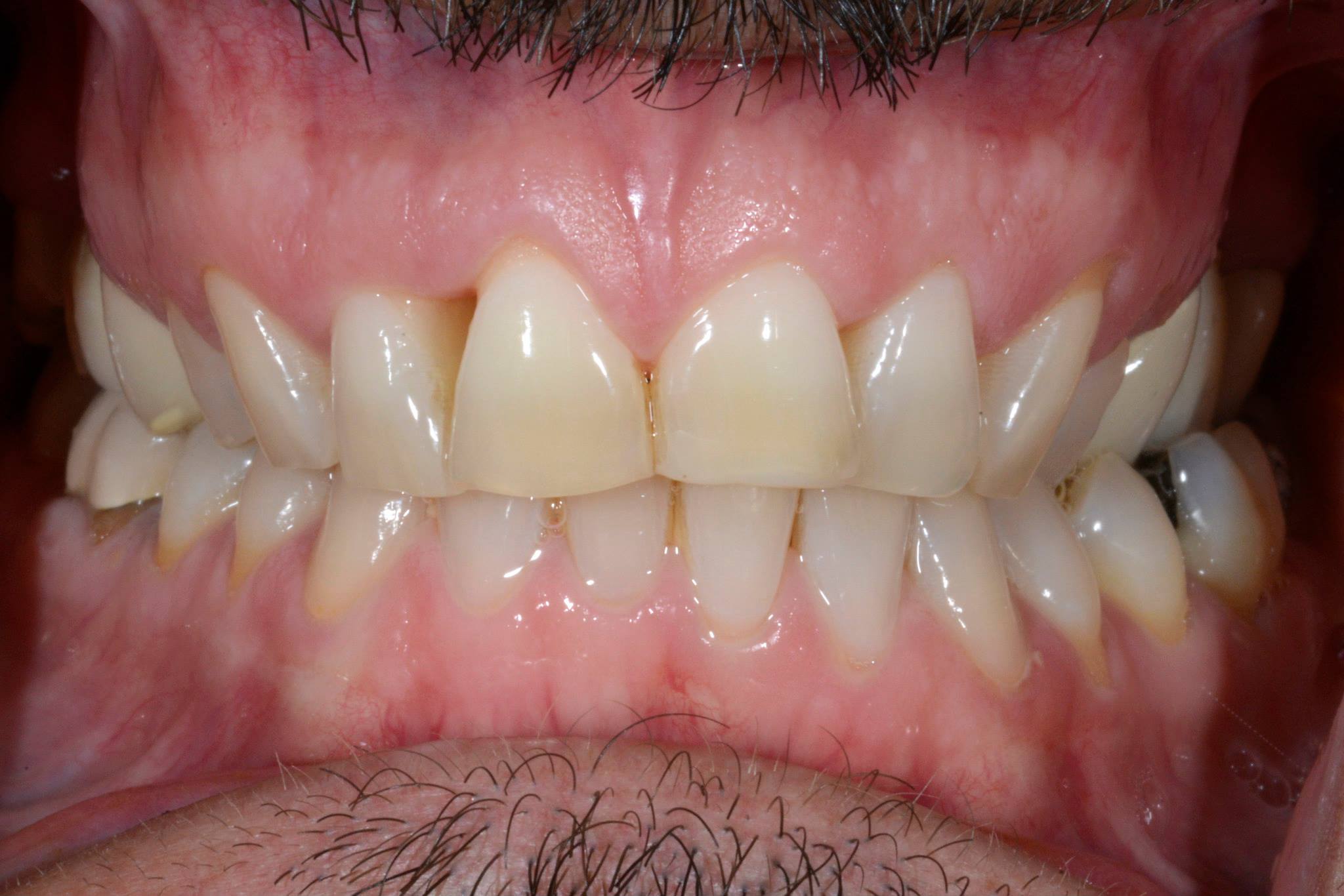 1911026 384526748363225 4306496791633334211 o